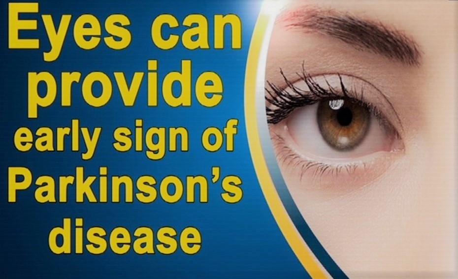 Eyes can provide early sign of Parkinson's disease Eye Health Nepal