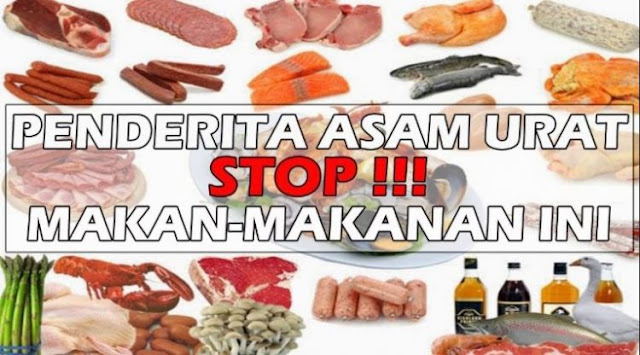 Kenali Penyebab, Pengobatan dan Gejala Asam Urat