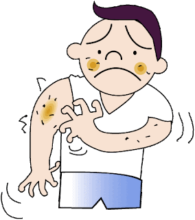 allergic-reaction-clip-art-358079 Miskonsepsi Tentang Alergi