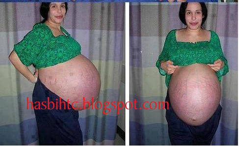 Seorang Ibu Melahirkan 11 Bayi Sekaligus Seorang Ibu Melahirkan 11 Bayi Sekaligus