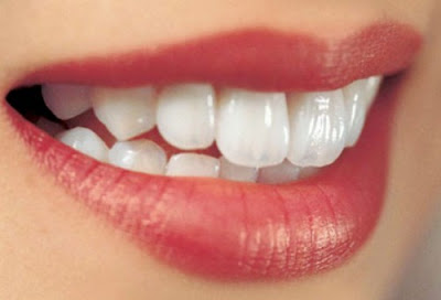 Những cách làm trắng răng hiệu quả