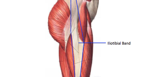 Physical Therapy 101: Best Treatment Approach for IT Band Syndrome