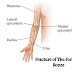 Overview of Fracture of The Forearm Bones