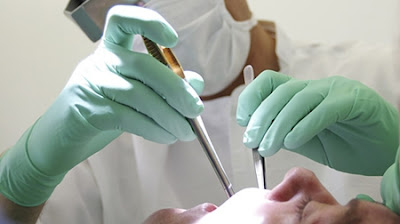 Implant giá bao nhiêu tại nha khoa Đăng Lưu