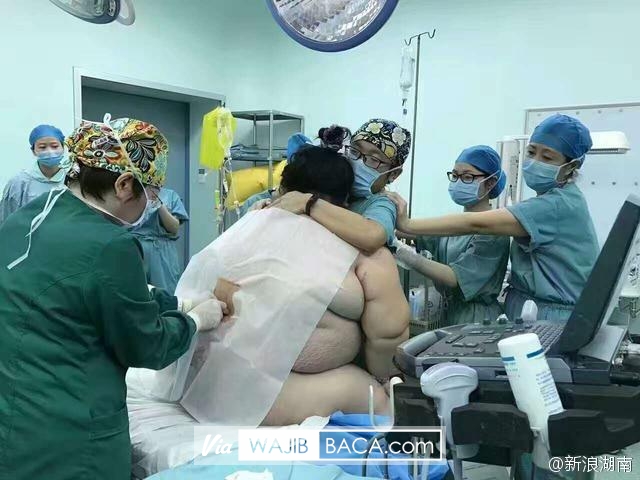 Astaga!, Dibutuhkan 16 Dokter Untuk Bantu Wanita Ini Melahirkan Karena Wanita Ini Memiliki... Astaga!, Dibutuhkan 16 Dokter Untuk Bantu Wanita Ini Melahirkan Karena Wanita Ini Memiliki...