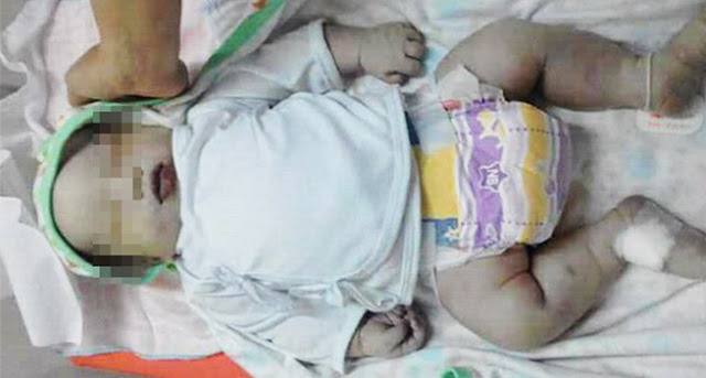 Sudah Putuskan Melahirkan Caesar Karena Bayi Terlalu Besar, Dokter Ini Malah Ngotot Selanjutnya Bikin Terenyuh Sudah Putuskan Melahirkan Caesar Karena Bayi Terlalu Besar, Dokter Ini Malah Ngotot Selanjutnya Bikin Terenyuh