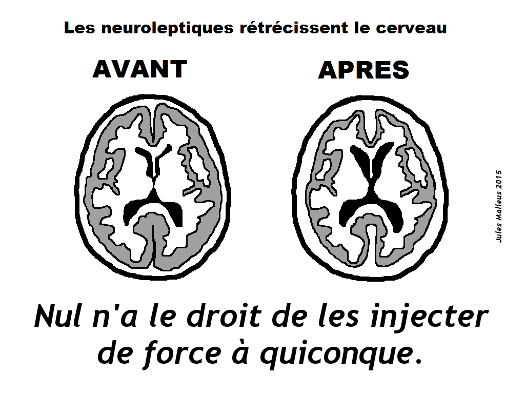 Le dommage cérébral "thérapeutique"