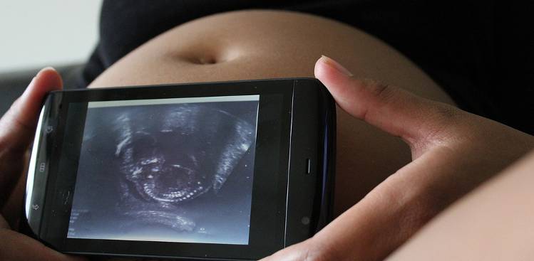 mujer embarazada sujeta smartphone con ecografía fetal