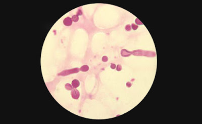 Malasezia Panvet izgled pod mikroskopom
