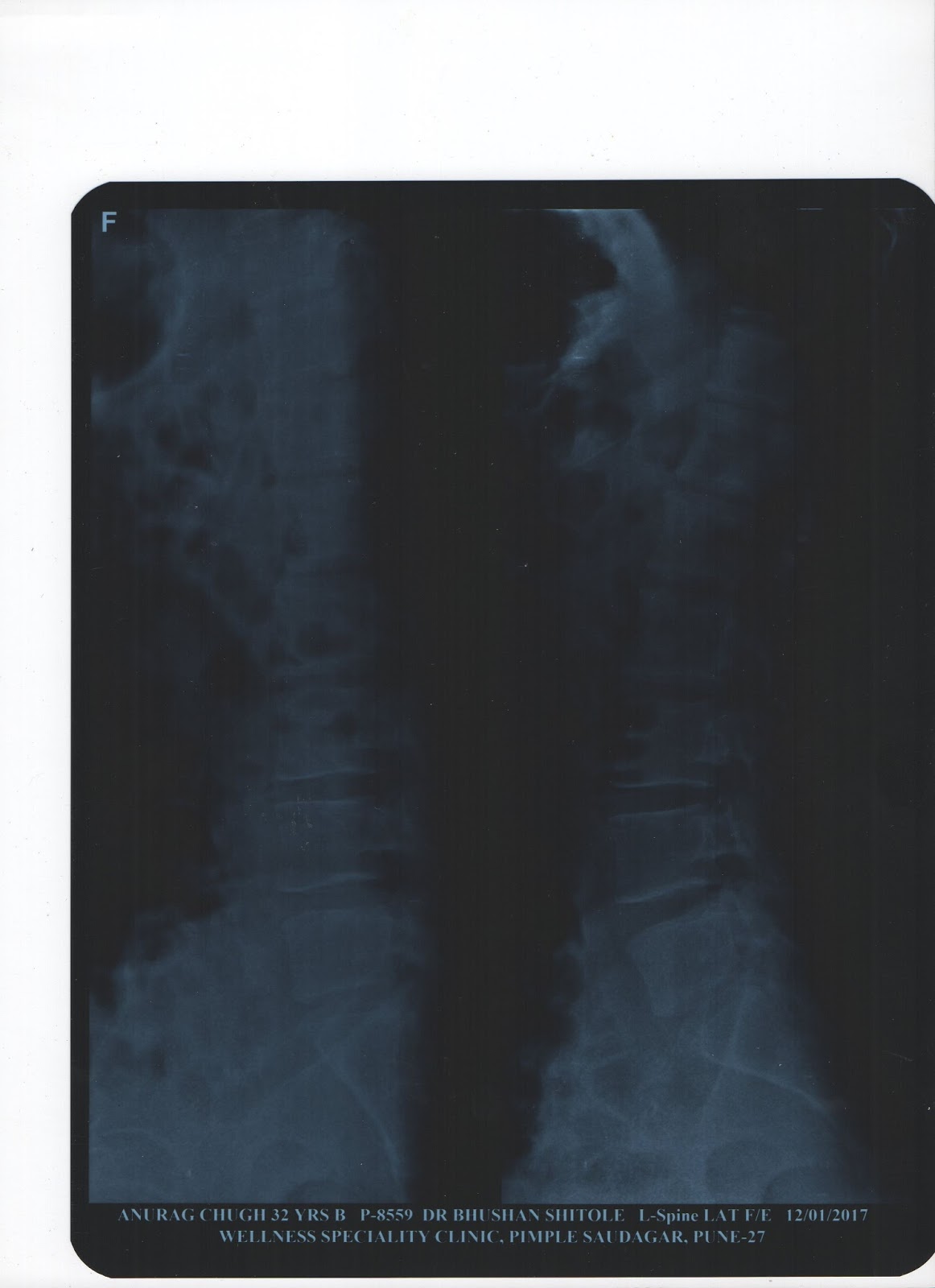 Electronics FAQ Scanning XRay Films