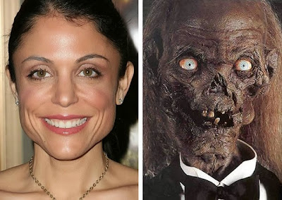 Bethenny Frankel before and after funny cosmetic surgery