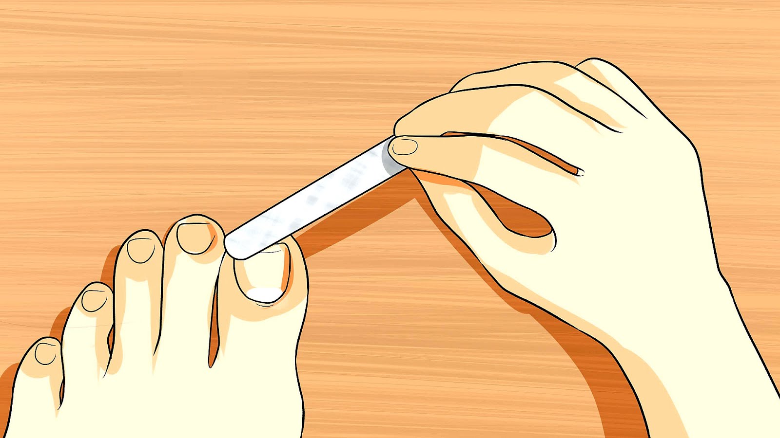 What Does It Mean If Your Toenails Are Yellow Yellow Choices