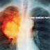 Early Dangerous Signs and Symptoms of Lung Problem In Men And Women