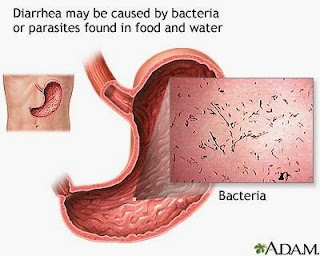 Bakteri Penyebab Diare