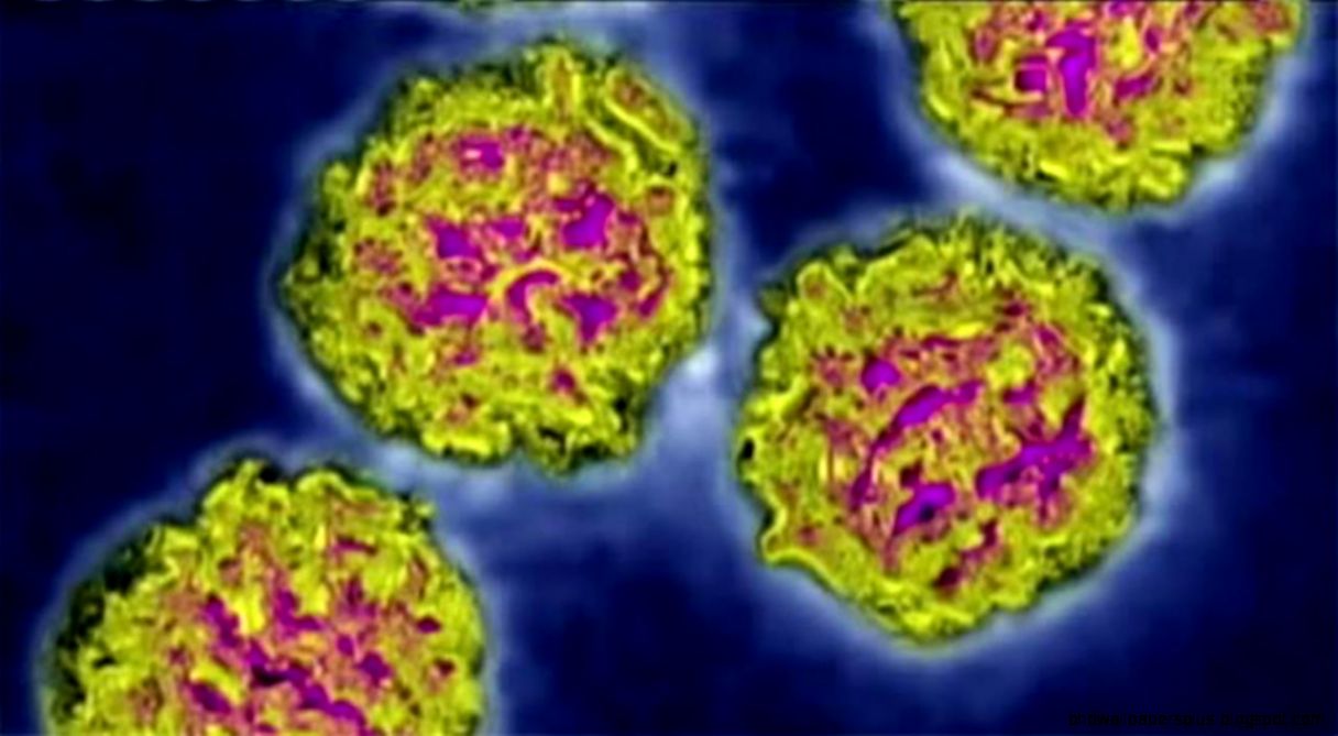 Alameda County health officials confirm two cases of enterovirus