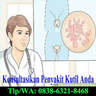 http://pengobatankutilkelaminherbal13.strikingly.com