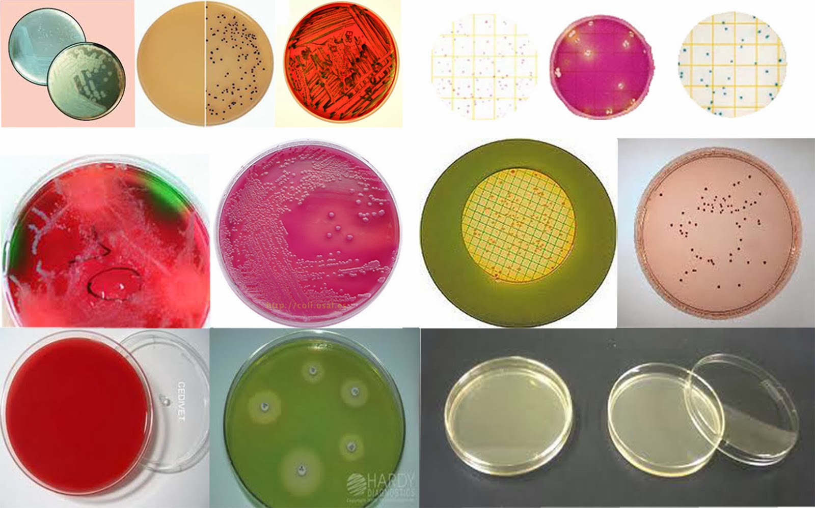 LABORATORIO Y MICROBIOLOGÍA MEDIOS DE CULTIVO