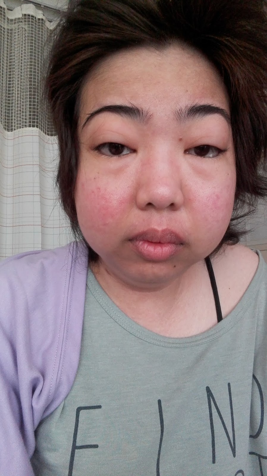 Fighting Lupus in Japan New roller coaster ride! July 2018