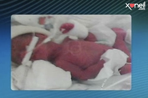 Tirinha Gordo Fresco: Você acredita em milagre? Bebê recém nascido volta a respirar após 5 horas de dar entrada no necrotério!