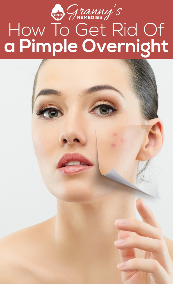 How To Get Rid Of A Pimple Overnight ? Granny's Remedies