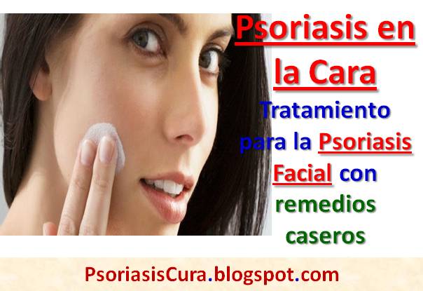 La psoriasis sobre la rodilla la fase inicial