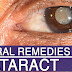 Remove Cataract without surgery and Improve Eyesight Fully with Castor Oil !!