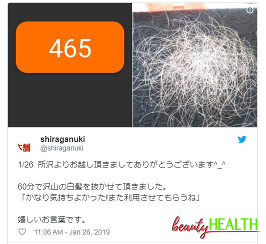 Unik! Ada Toko Khusus Mencabut Uban, Tarifnya Mulai Rp500 Ribuan