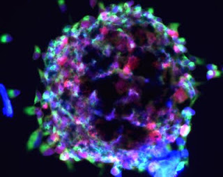 Las células madre, esperanza para controlar la esclerosis múltiple