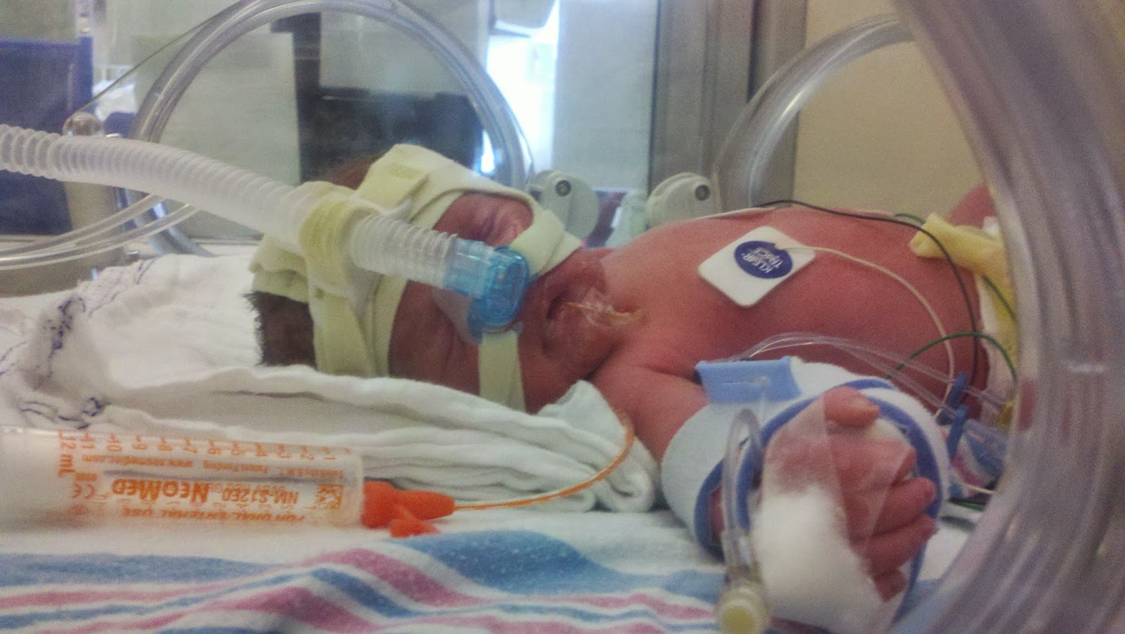 Brandich, Party of Five! Babies age 0 weeks Life in the NICU