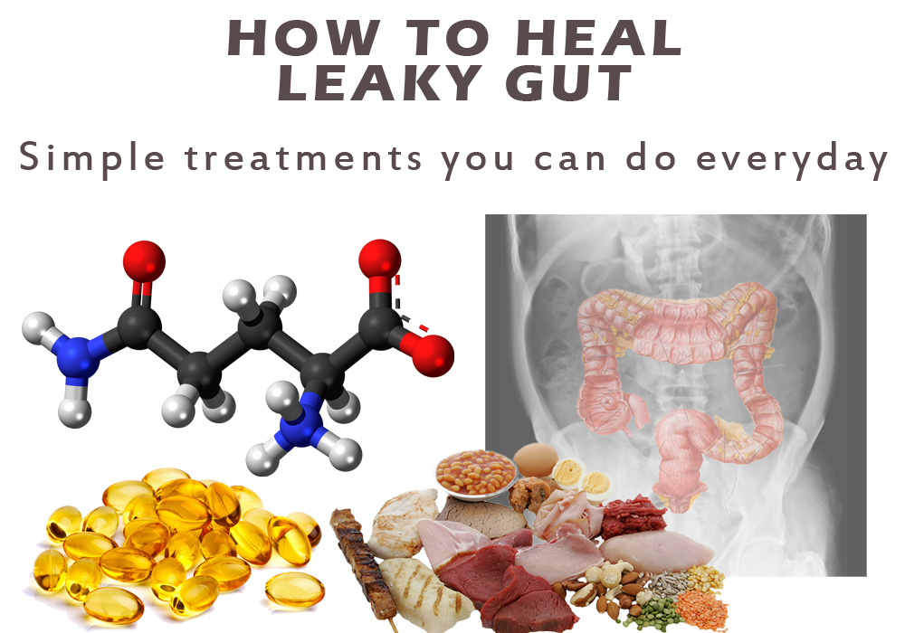 How to Heal Leaky Gut Syndrome Symptoms Treatments