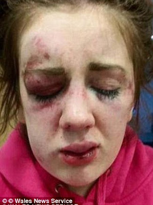 police do nothing as teen mother is beaten