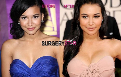 Naya Rivera Plastic Surgery Before and After Breast Implants.