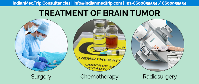 What is Glioblastoma Multiforme‬ and what are Treatments