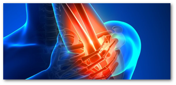 tratamente pentru boli articulare artrita reumatoidă a cotului