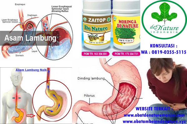 10 Rekomendasi Obat Maag Paling Ampuh Di Apotek