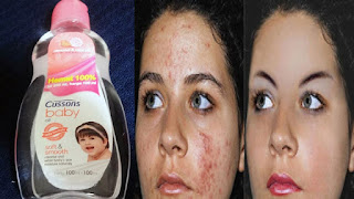  mungkin sangat familiar sebagai oil untuk merawat kulit bayi Cara Memakai Baby Oil Untuk Wajah, Kulit Dan Rambut