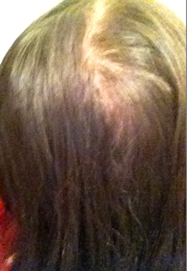 Miri boheme Thin hair. Sick of it! My Hair Regrowth Journey