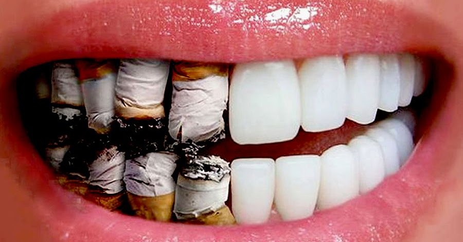 NOTIDENTAL: Estudiantes de Odontología ayudan a adictos a la nicotina a