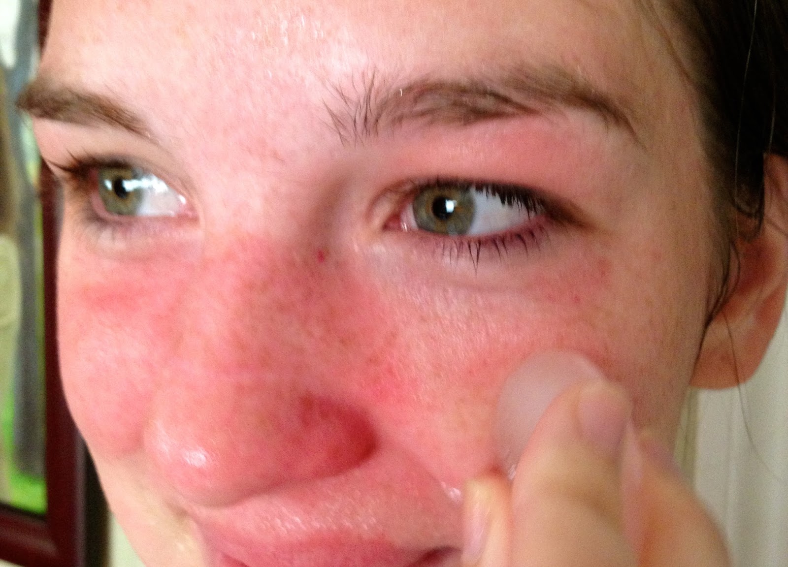 Jalapeno Juice In Eye Jalapeno 101