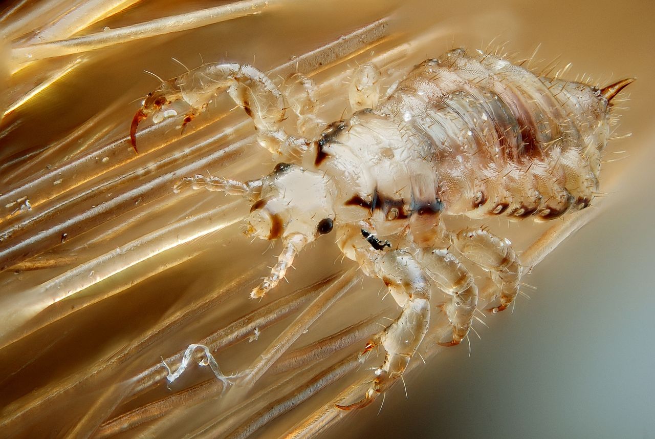 Head Lice Facts Helth