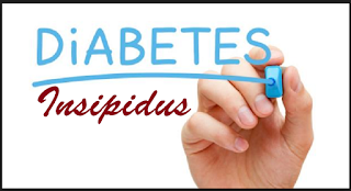 Artikel cendekiawan bagi komplikasi diabetes insipidus, Komplikasi Diabetes Insipidus - Alodokter, Diabetes insipidus - Gejala, penyebab dan mengobati - Alodokter, DIABETES INSIPIDUS ; PENYEBAB, GEJALA, KOMPLIKASI DAN