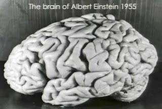 Albert Einstein's brain