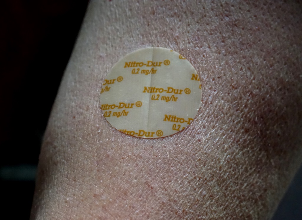 Nitroglycerin Skin Patches Pictures