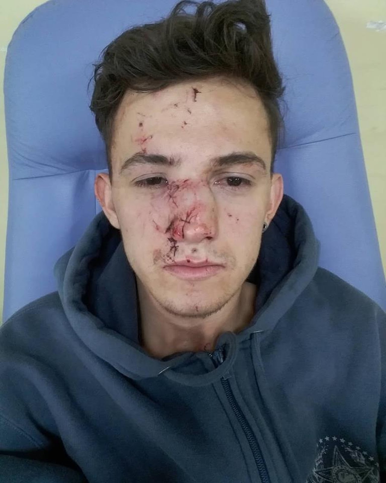 Rio tem protesto em apoio a fotógrafo gay que teve rosto cortado por copo de vidro Rio tem protesto em apoio a fotógrafo gay que teve rosto cortado por copo de vidro