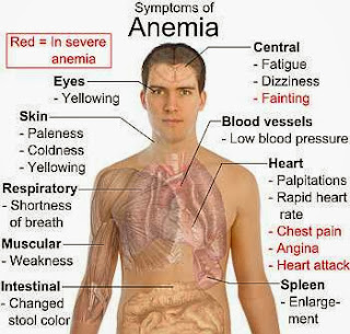 simpton anemia, kurang darah 
