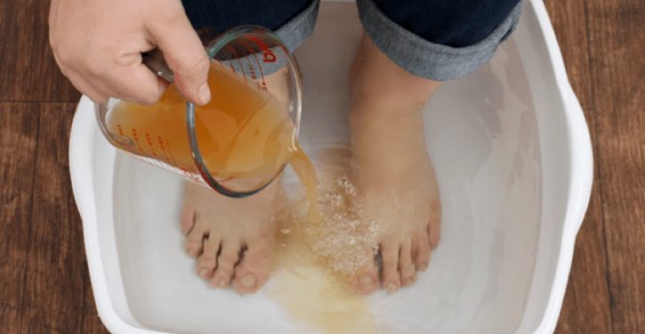 Put Your Feet In Vinegar For 15 Minutes, It's Great For Your Health