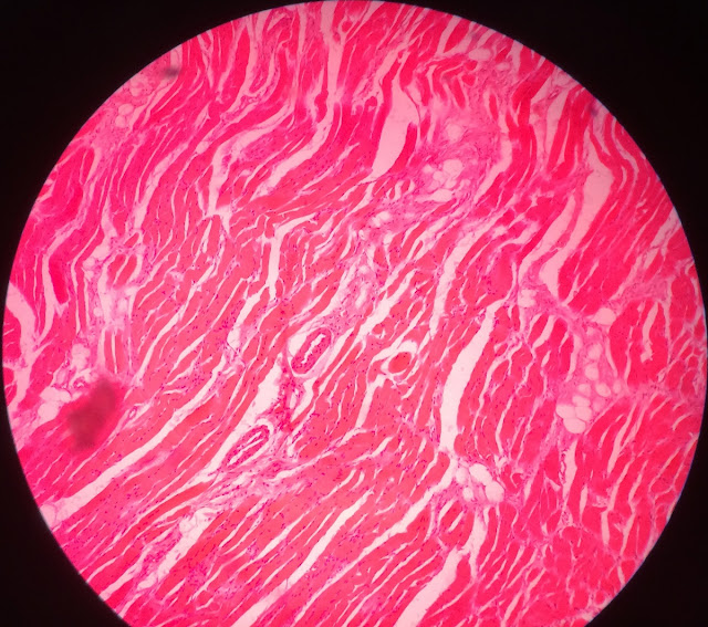 histology slide of skeletal muscle