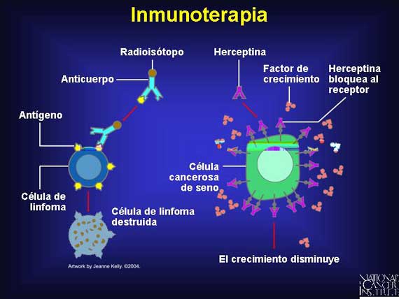 inmunoterapia cancer que es