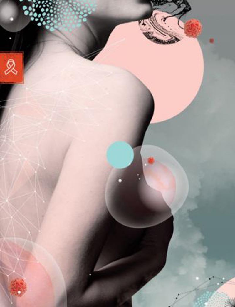 4 Steps to Get Your Life Back on Track Do you really need a double mastectomy?