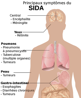 Mycose génitale chez l’homme : symptômes et traitements de la balanite du gland